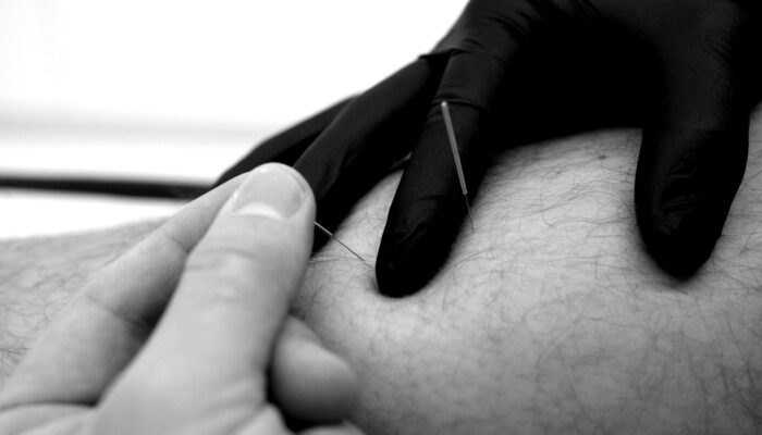 7IV05645-1-scaled-blackwhite